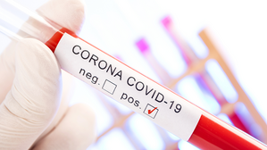 Dreimal wurde der Mann innerhalb weniger Wochen positiv auf Corona getestet. © Adobe Stock: A_Bruno Dreimal wurde der Mann innerhalb weniger Wochen positiv auf Corona getestet. © Adobe Stock: A_Bruno