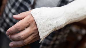 Gebrochener Arm nach Armdrücken in der Pause 
© Adobe Stock - Von M.Dörr & M.Frommherz