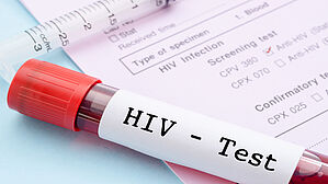 Sind HIV-Positive für den Polizeidienst untauglich? Copyright by gamjai / Fotolia