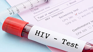 Sind HIV-Positive für den Polizeidienst untauglich? Copyright by gamjai / Fotolia Sind HIV-Positive für den Polizeidienst untauglich? Copyright by gamjai / Fotolia